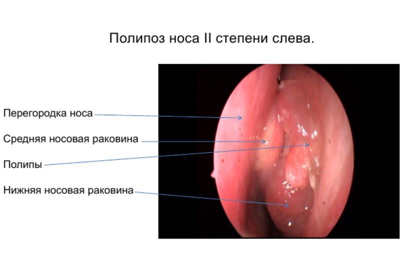 pari-sinus-4