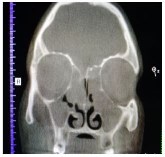 pari-sinus-8