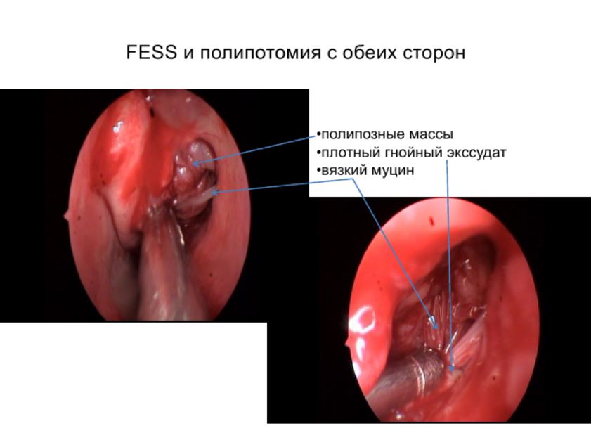 pari-sinus-9