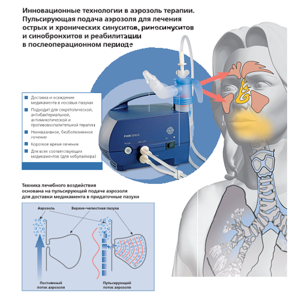 PARI SINUS - ингаляционный прибор с пуьсирующей подачей аэрозоля